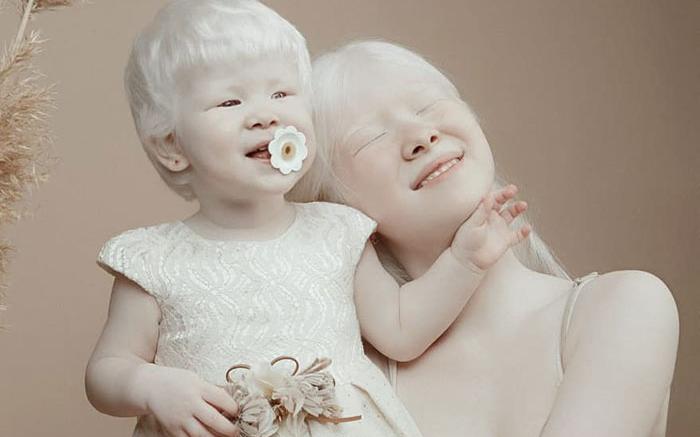 boommag-albino-sisters-