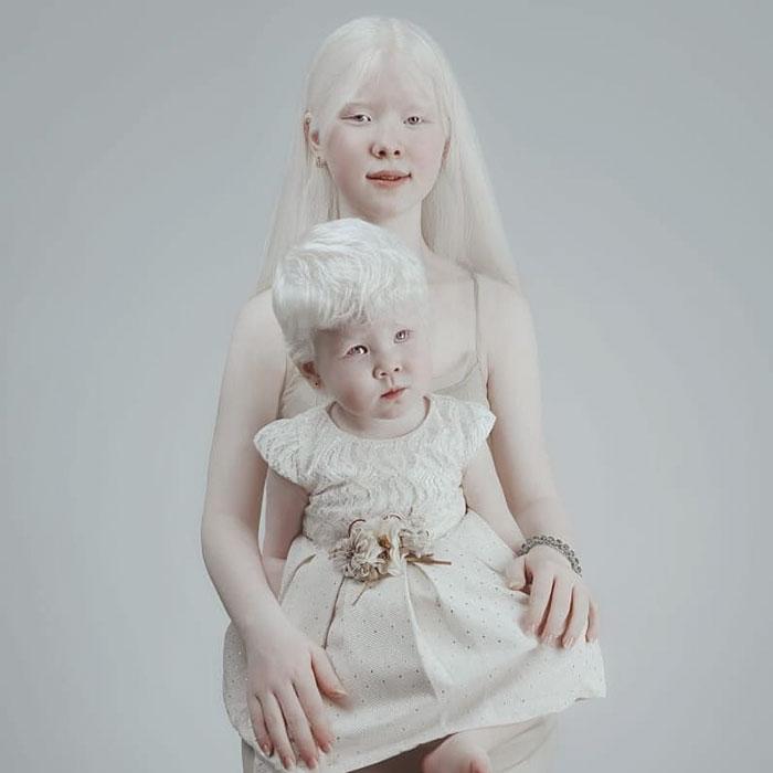 boommag-albino-sisters-6