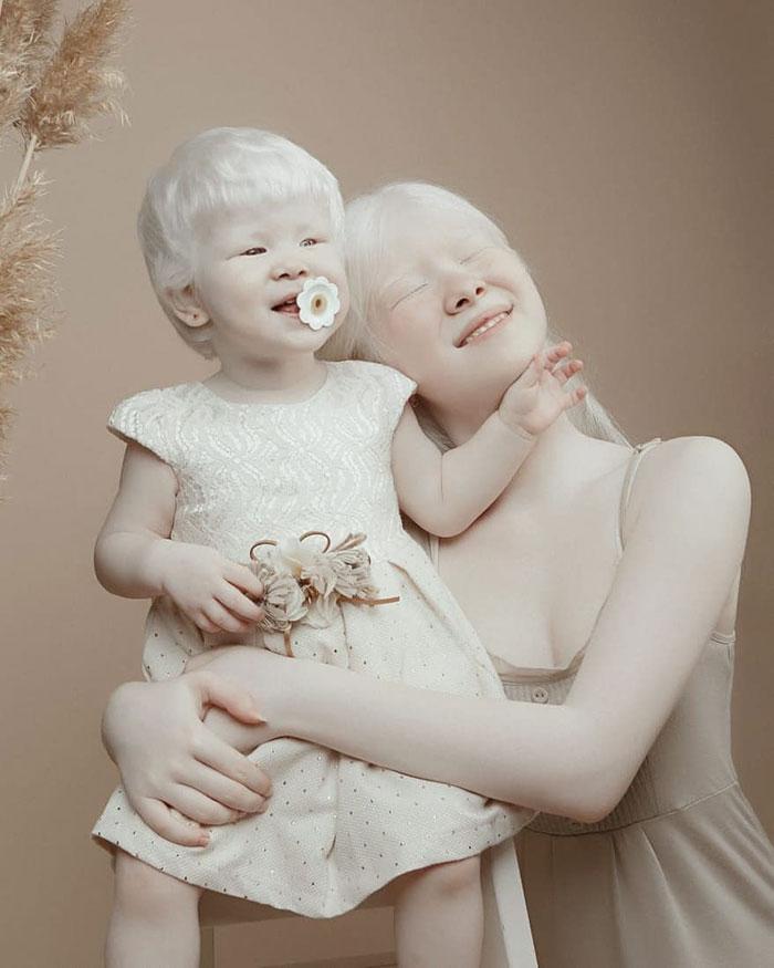 boommag-albino-sisters-7