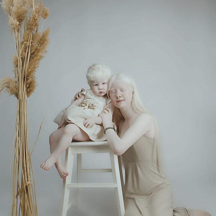 boommag-albino-sisters-9