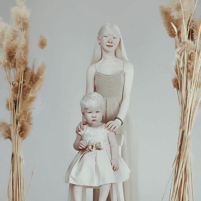 boommag-albino-sisters-10