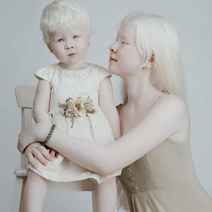 boommag-albino-sisters-4